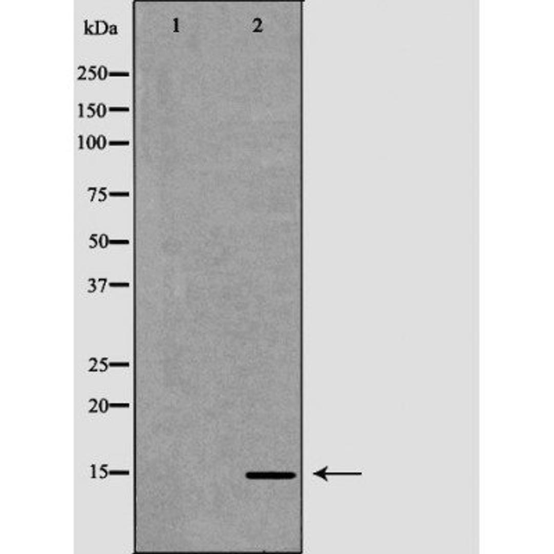 Western blot analysis of Caco-2 cell lysate using CCL21 antibody