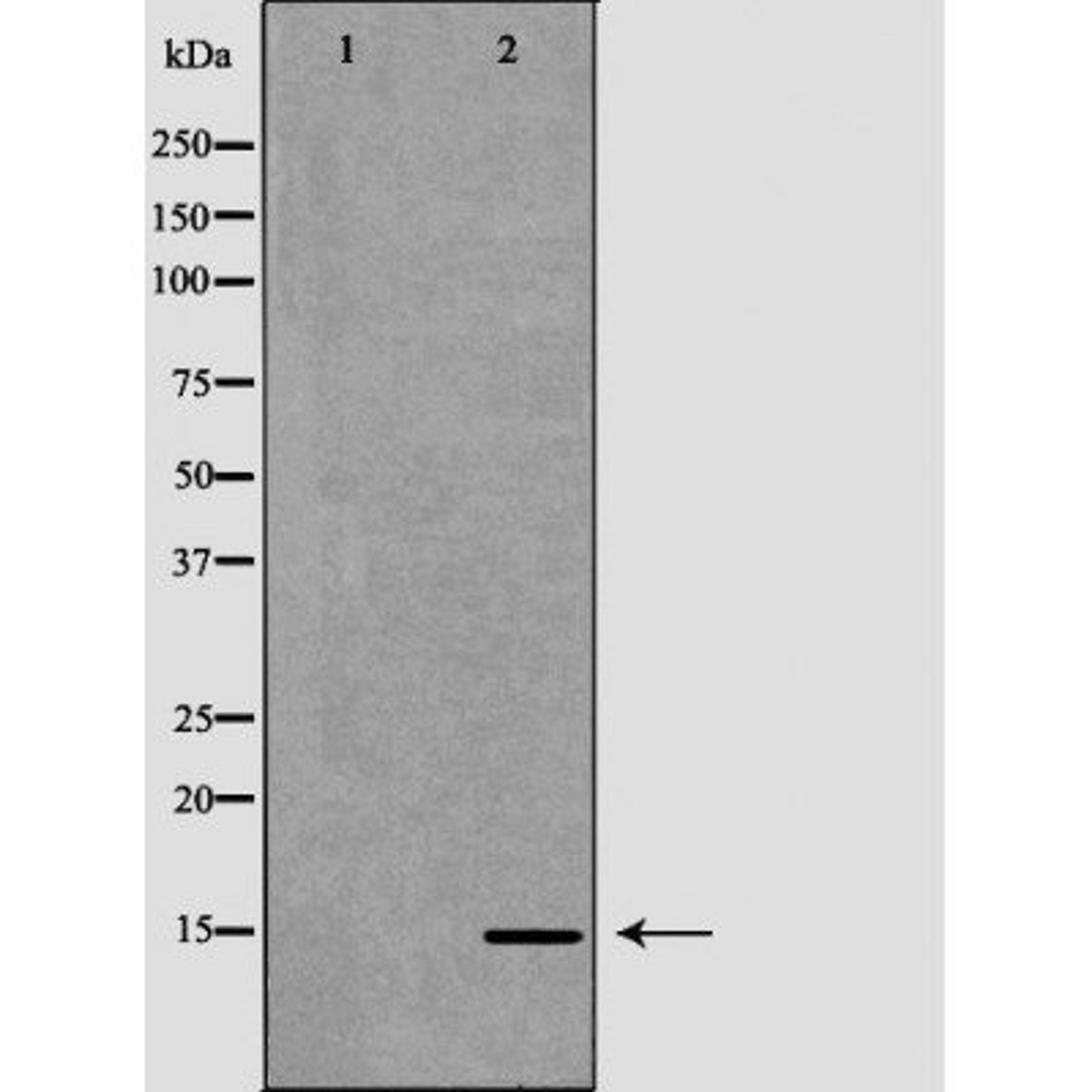 Western blot analysis of Caco-2 cell lysate using CCL21 antibody