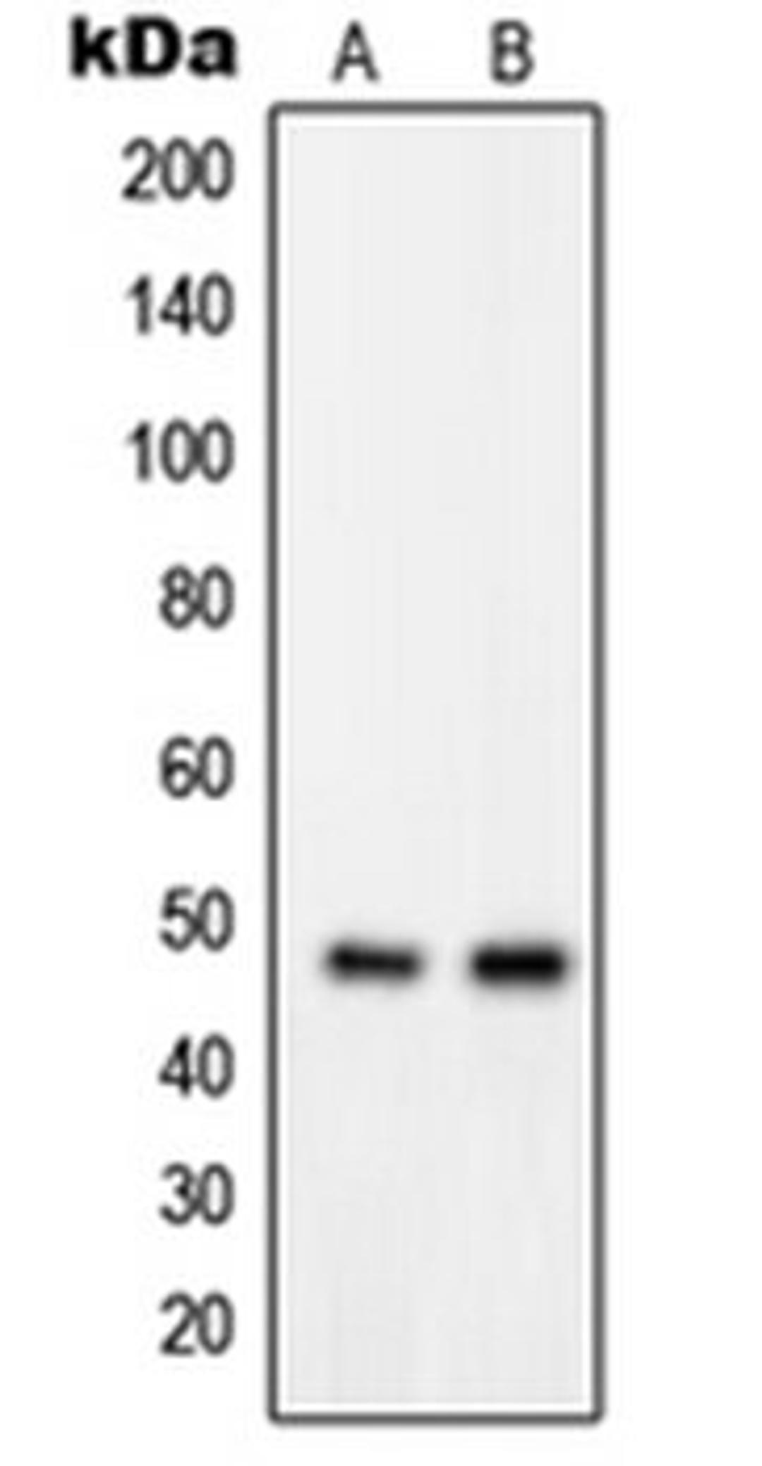 Western blot analysis of MDAMB435 (Lane 1), K562 (Lane 2) whole cell lysates using GPRIN2 antibody