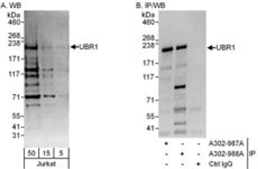 Detection of human UBR1 by western blot and immunoprecipitation.