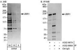 Detection of human UBR1 by western blot and immunoprecipitation.