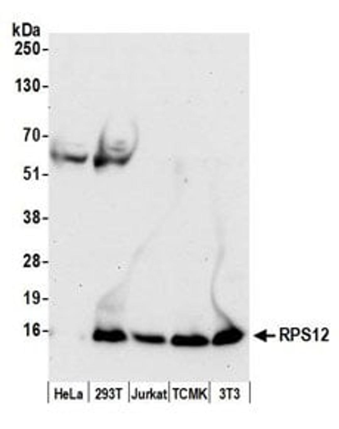 Detection of human and mouse RPS12 by western blot.