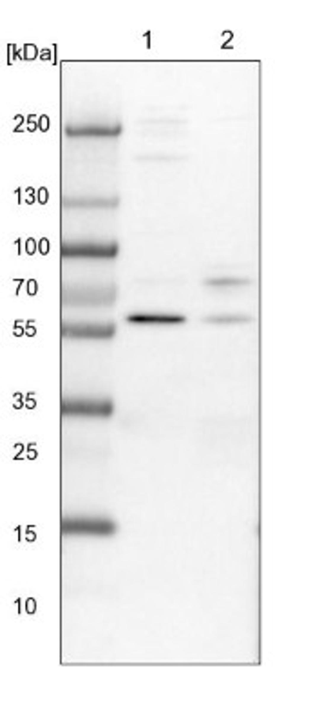 Western Blot: C1orf114 Antibody [NBP1-93901] - Lane 1: NIH-3T3 cell lysate (Mouse embryonic fibroblast cells)<br/>Lane 2: NBT-II cell lysate (Rat Wistar bladder tumour cells)