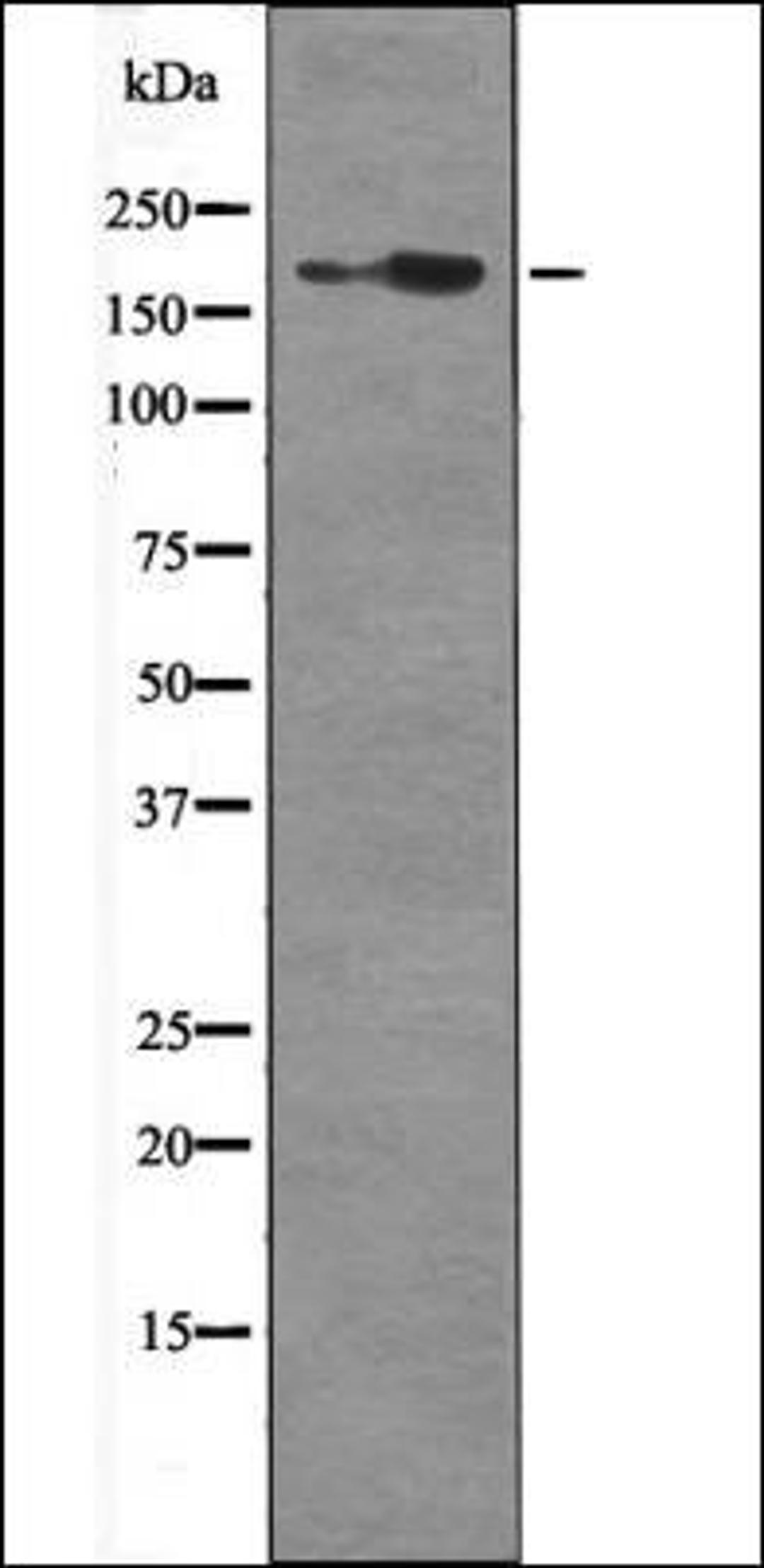 Western blot analysis of Mouse braintissue lysates using HER2 -Phospho-Tyr1139- antibody