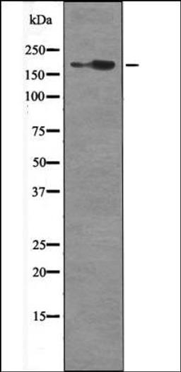 Western blot analysis of Mouse braintissue lysates using HER2 -Phospho-Tyr1139- antibody