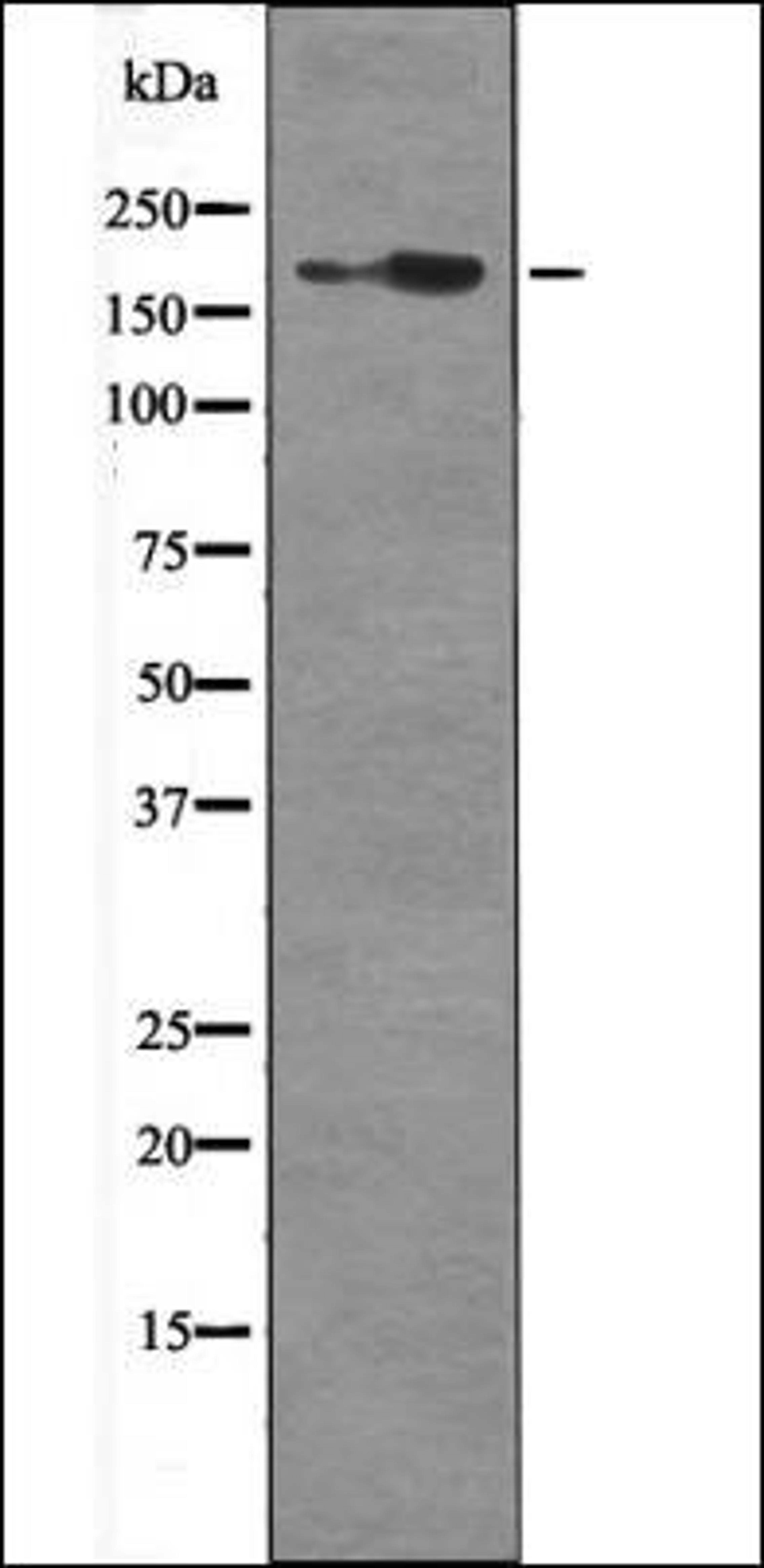 Western blot analysis of Mouse braintissue lysates using HER2 -Phospho-Tyr1139- antibody