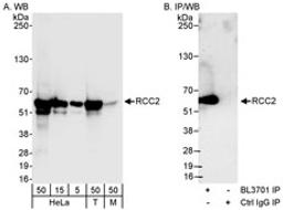 Detection of human and mouse RCC2 by western blot (h&m) and immunoprecipitation (h).