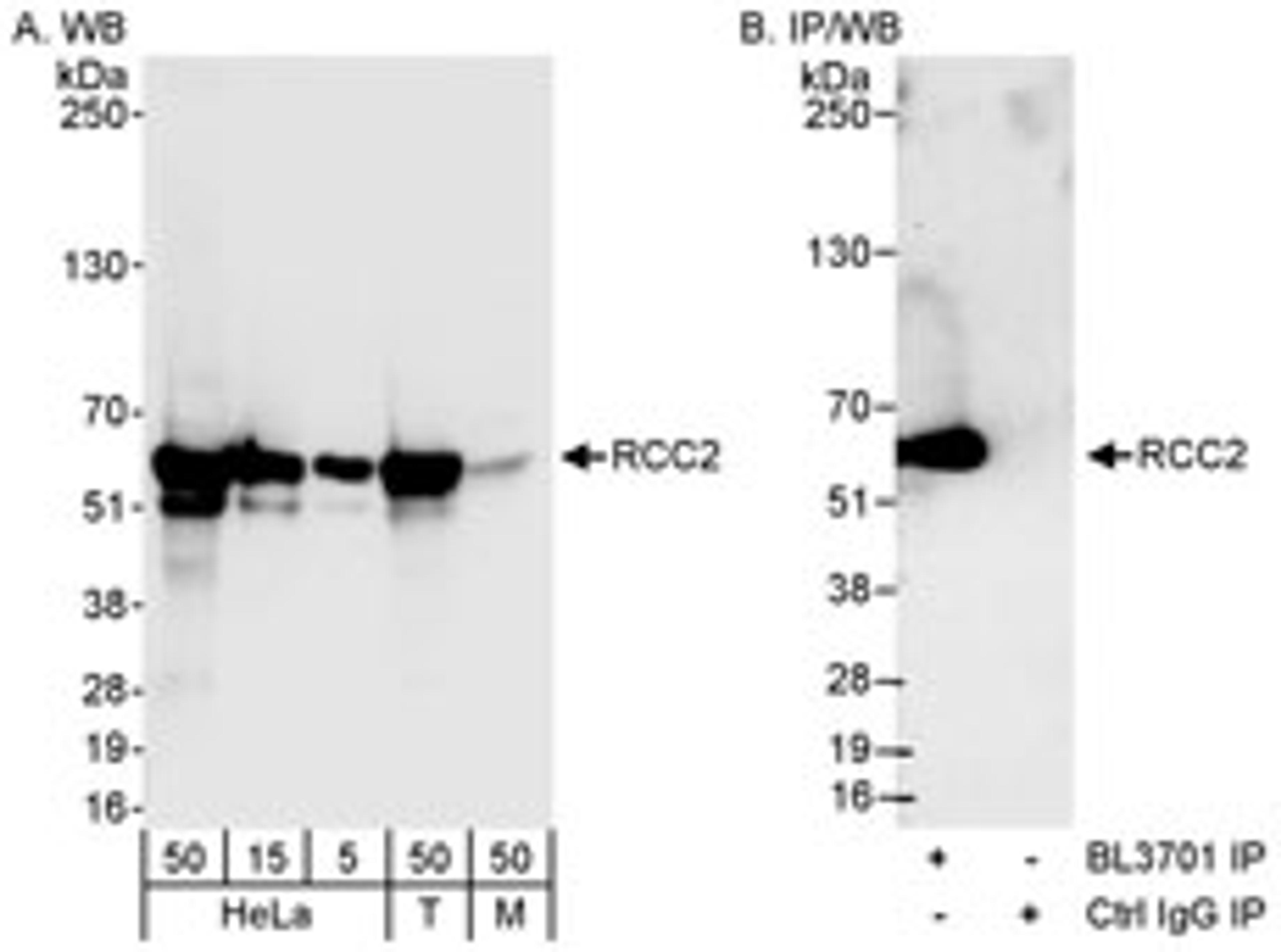 Detection of human and mouse RCC2 by western blot (h&m) and immunoprecipitation (h).