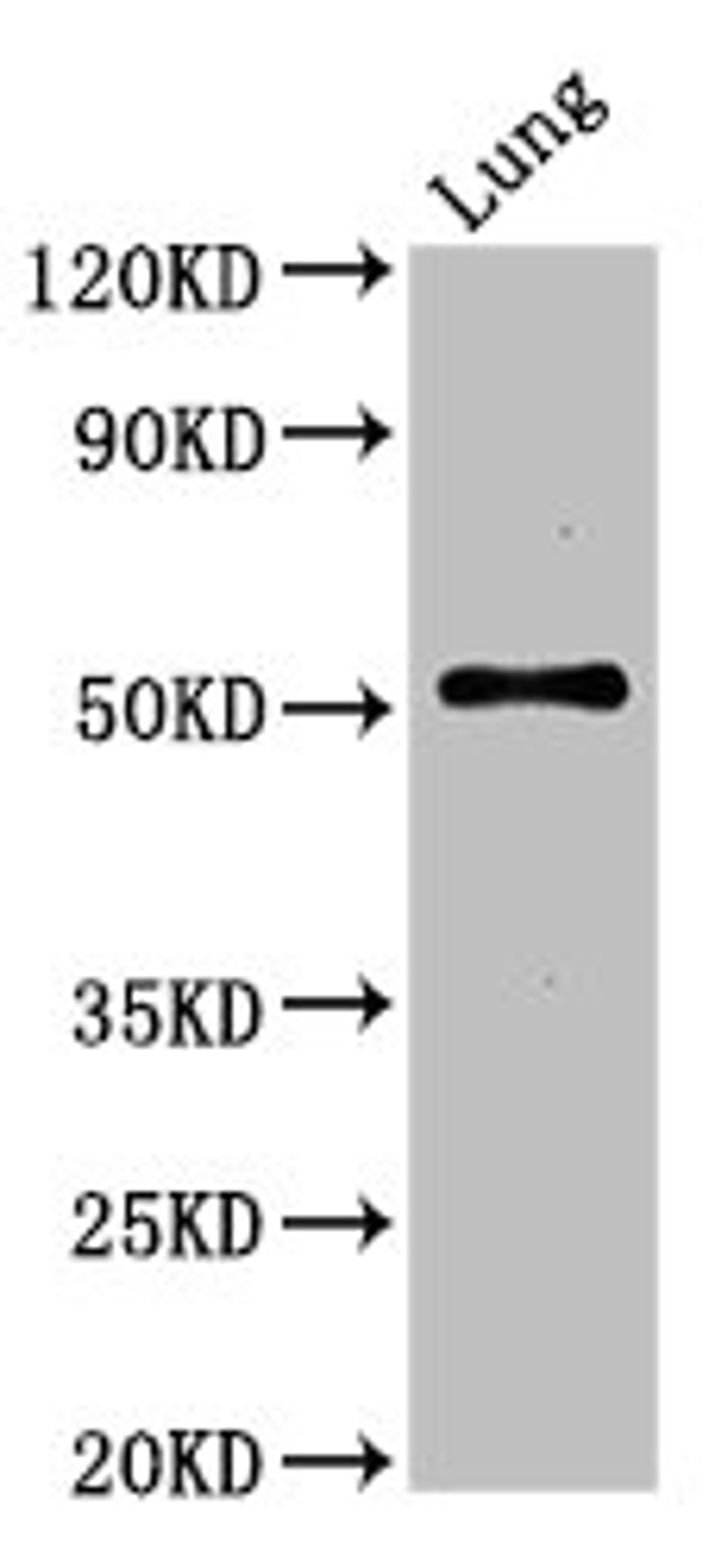 Western Blot. Positive WB detected in: Mouse lung tissue. All lanes: SERINC1 antibody at 3ug/ml. Secondary. Goat polyclonal to rabbit IgG at 1/50000 dilution. Predicted band size: 51 kDa. Observed band size: 51 kDa. 