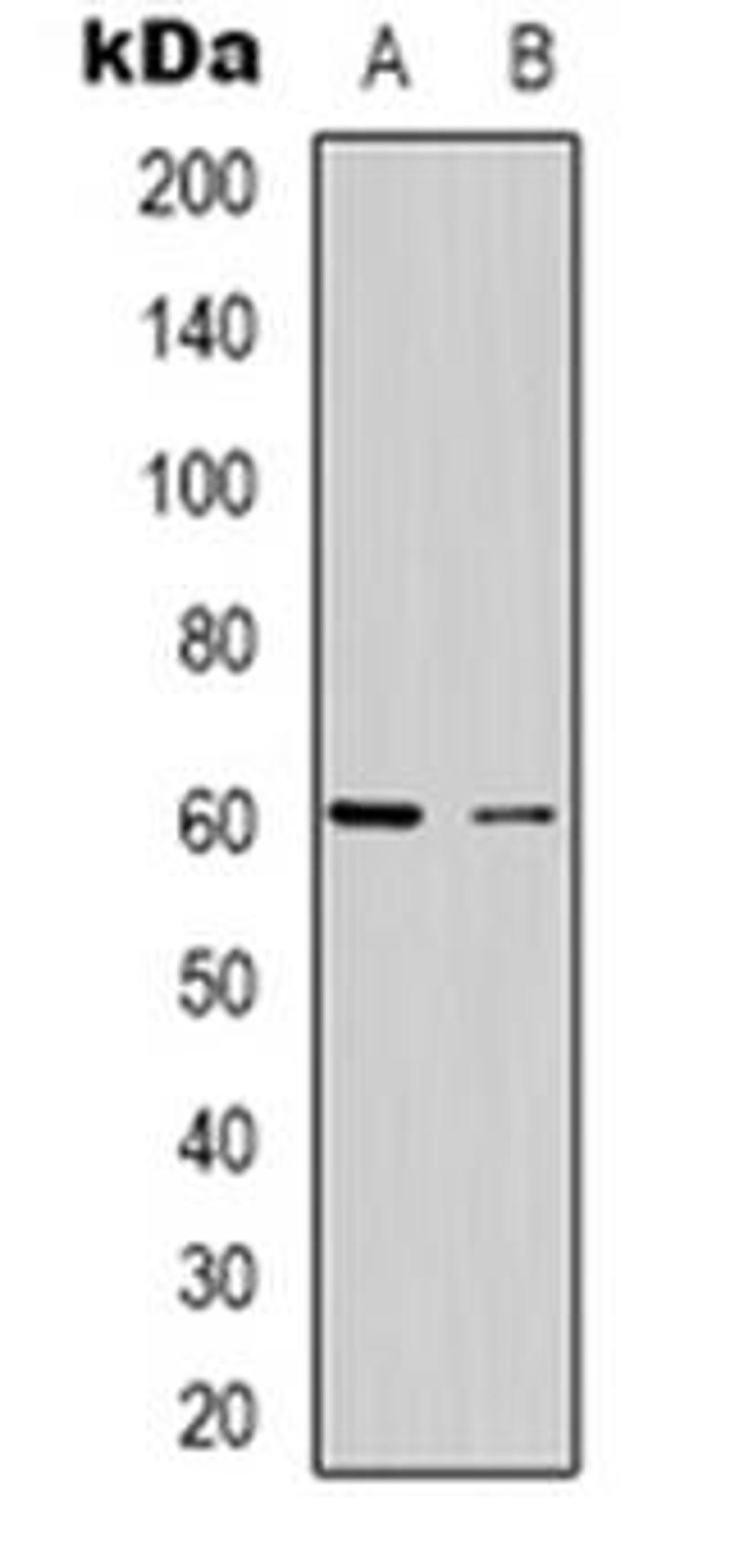 Western blot analysis of CABLES2 expression in Hela (Lane 1), Jurkat (Lane 2) whole cell lysates using CABLES2 antibody