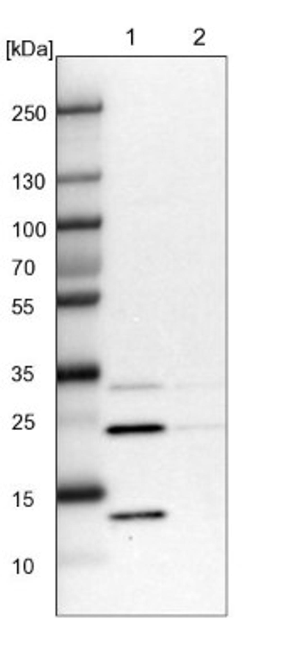 Western Blot: DCUN1D4 Antibody [NBP1-81526] - Lane 1: NIH-3T3 cell lysate (Mouse embryonic fibroblast cells)<br/>Lane 2: NBT-II cell lysate (Rat Wistar bladder tumour cells)