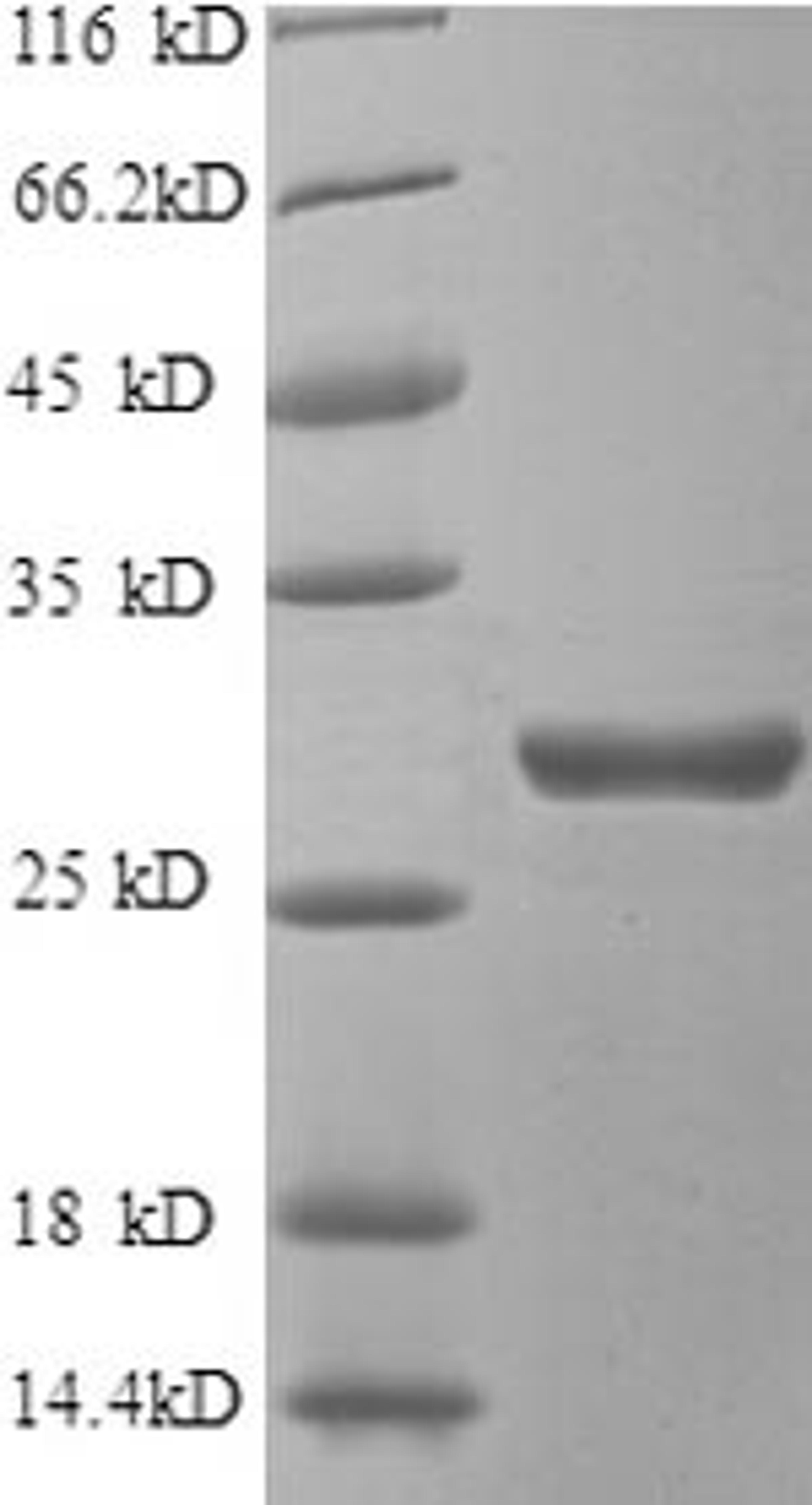 (Tris-Glycine gel) Discontinuous SDS-PAGE (reduced) with 5% enrichment gel and 15% separation gel.