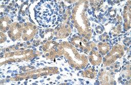 Antibody used in IHC on Human kidney.