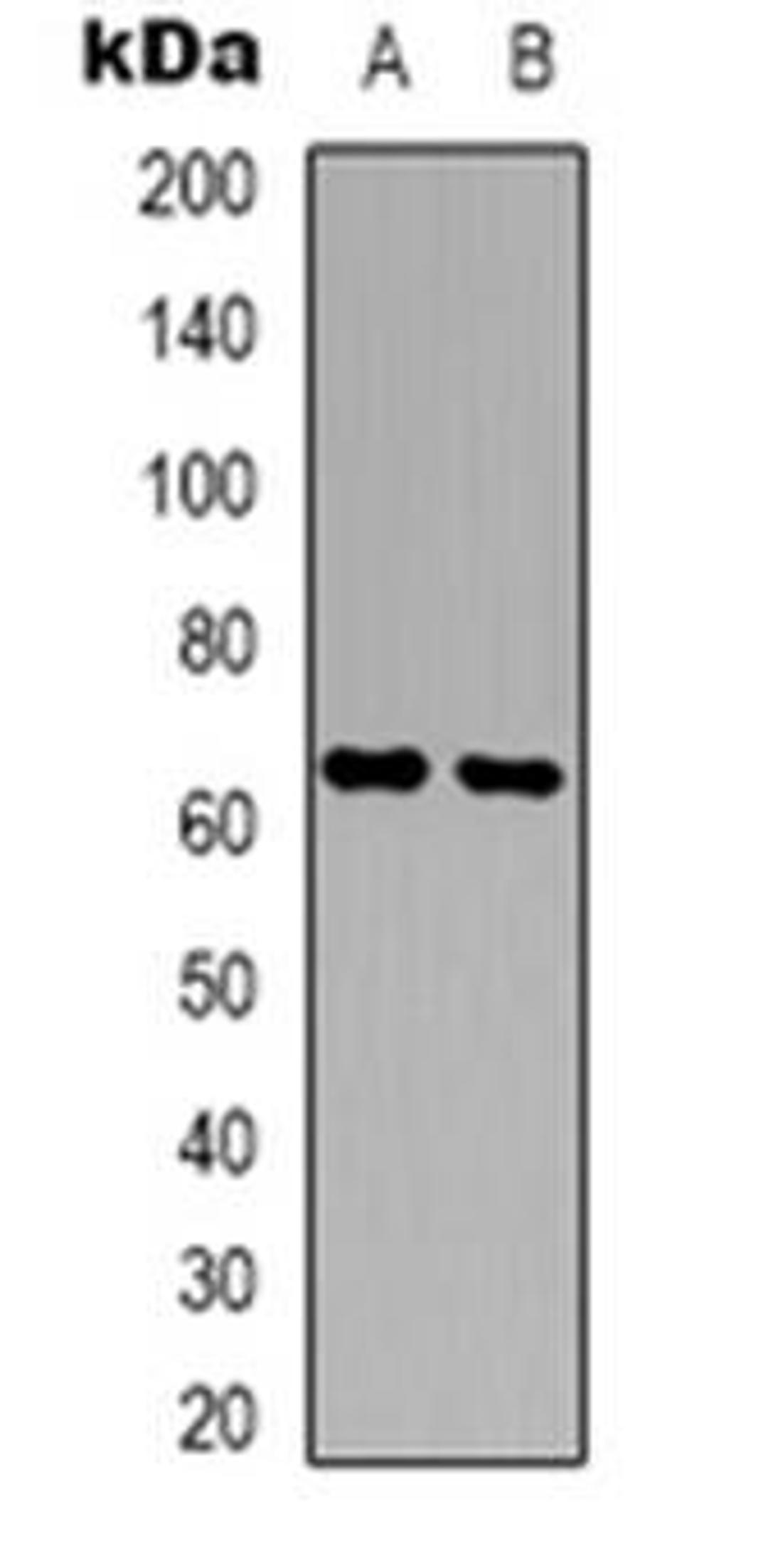 Western blot analysis of Copine 8 expression in A431 (Lane 1), NIH3T3 (Lane 2) whole cell lysates using CPNE8 antibody