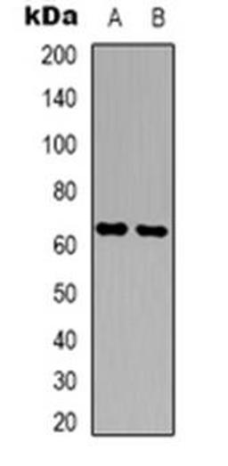 Western blot analysis of Copine 8 expression in A431 (Lane 1), NIH3T3 (Lane 2) whole cell lysates using CPNE8 antibody