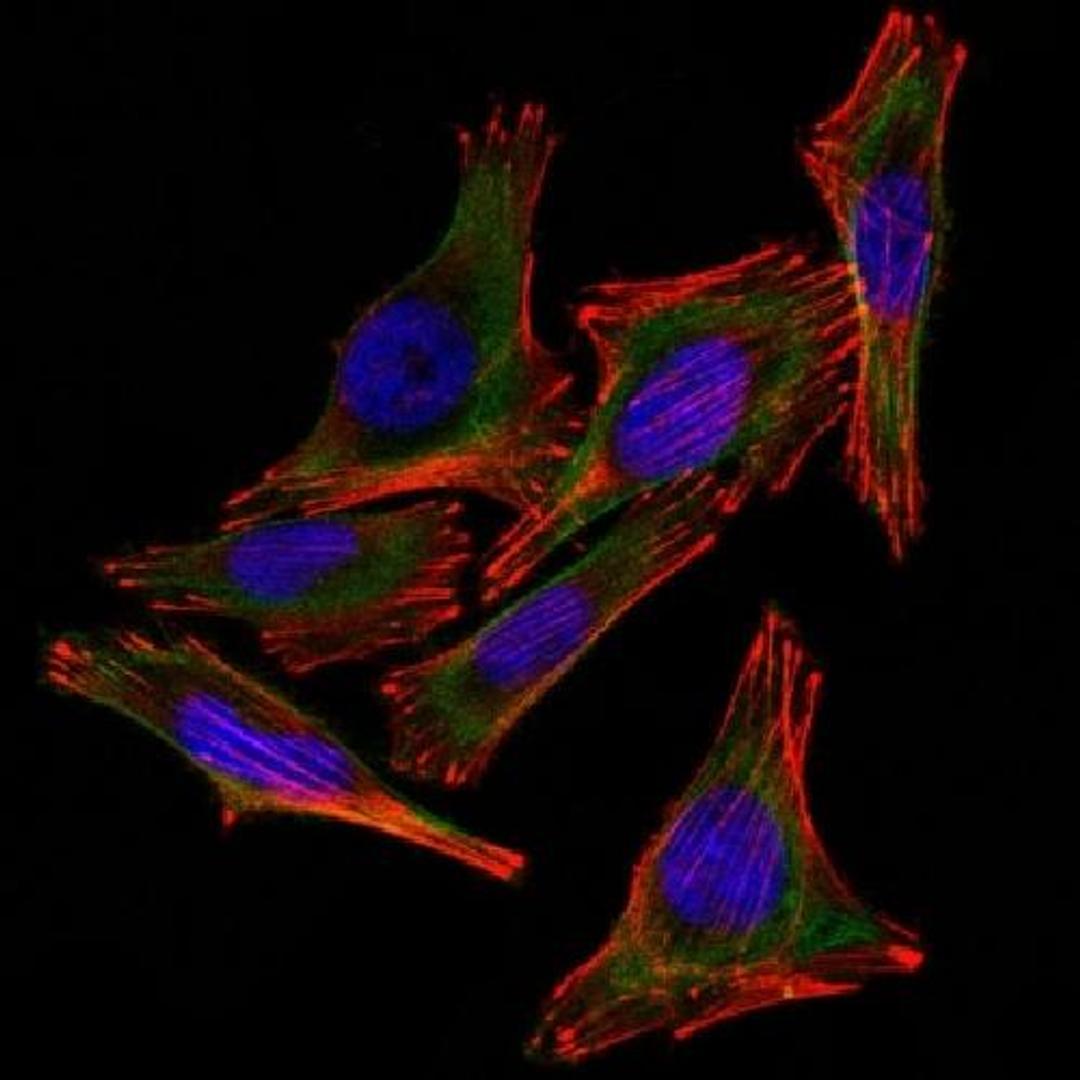 Immunofluorescence analysis of A2058 Cells using S100B antibody