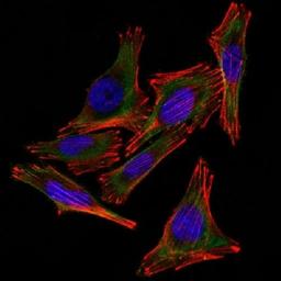 Immunofluorescence analysis of A2058 Cells using S100B antibody