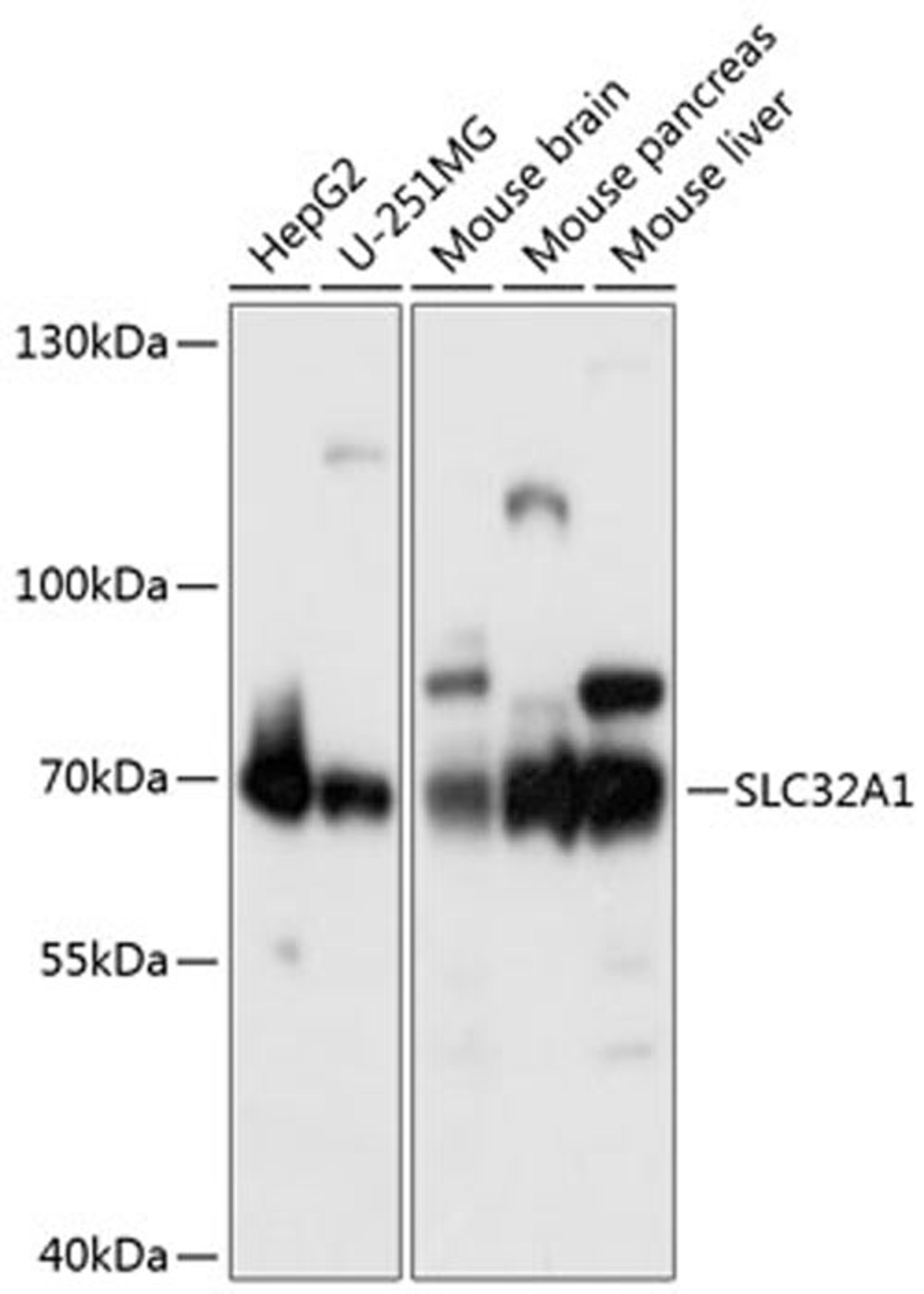 Western blot - SLC32A1 antibody (A12610)