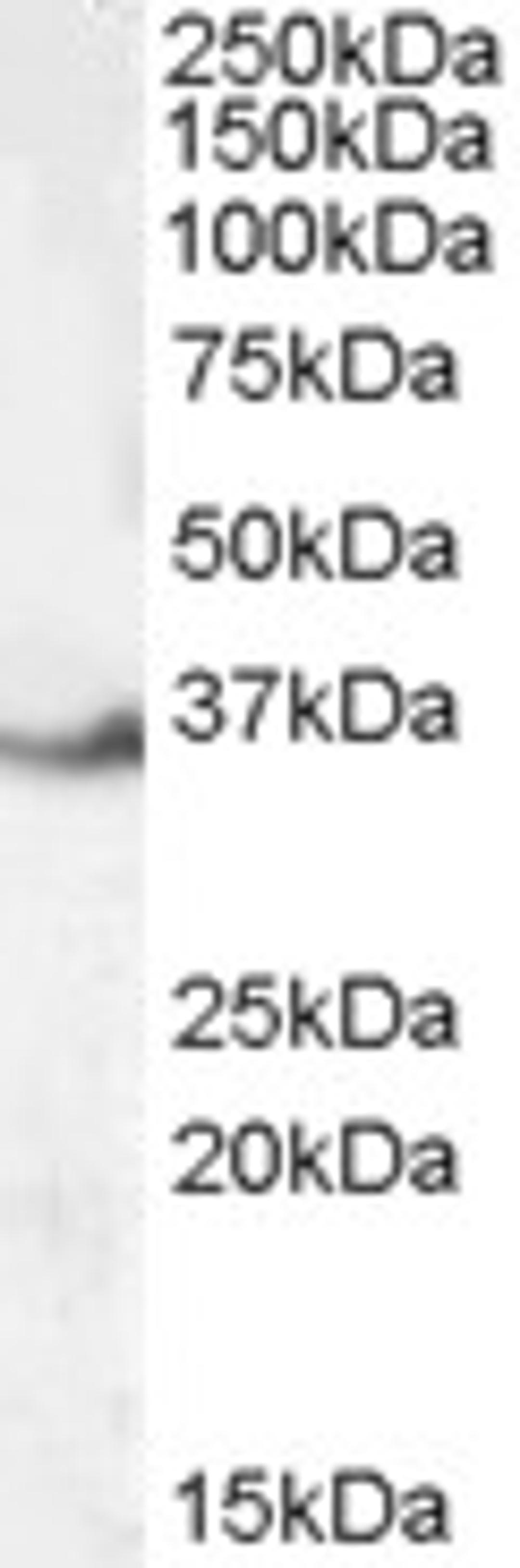 45-823 (0.1ug/ml) staining of Human Kidney lysate (35ug protein in RIPA buffer). Primary incubation was 1 hour. Detected by chemiluminescence.