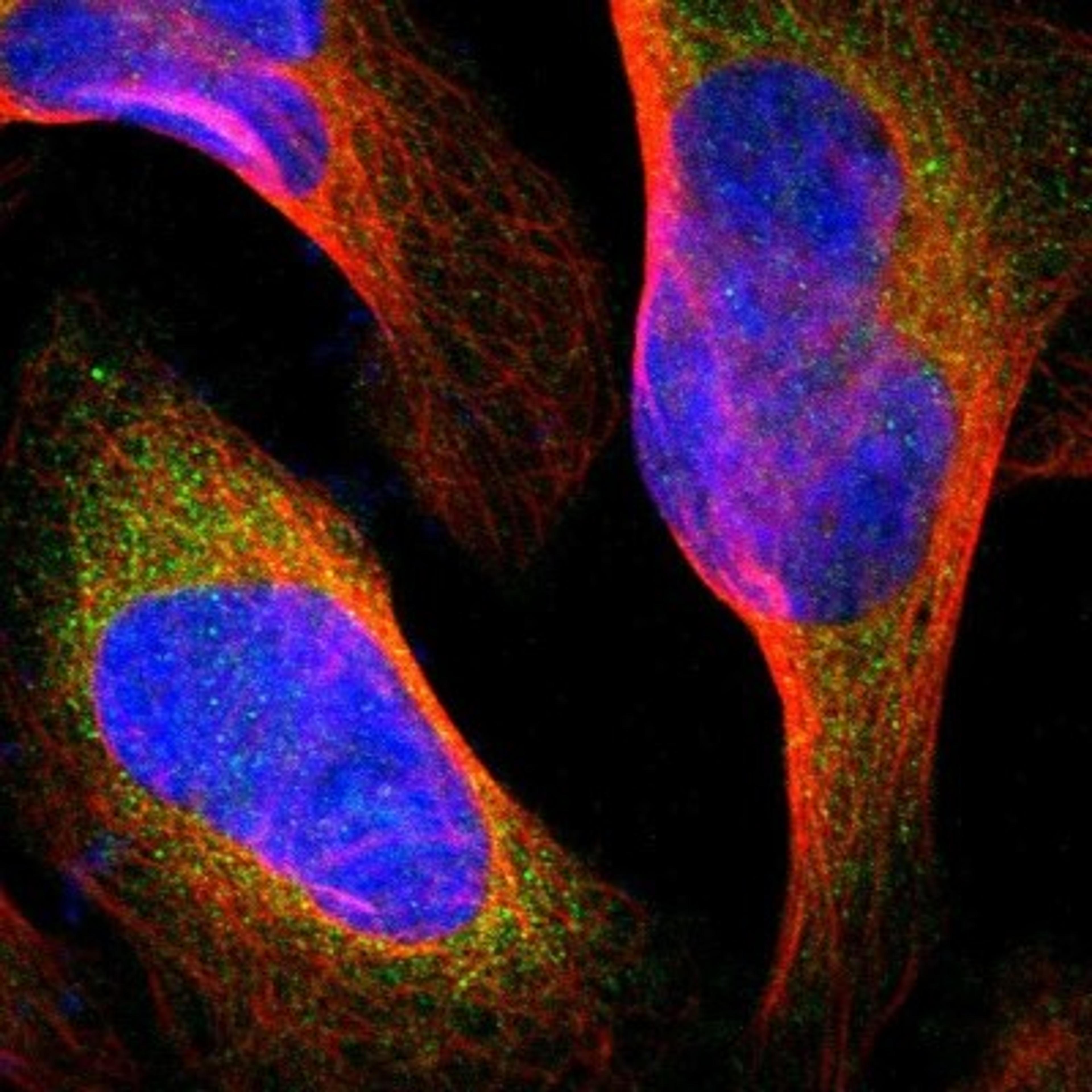 Immunocytochemistry/Immunofluorescence: FMNL1 Antibody [NBP1-88460] - Staining of human cell line U-2 OS shows positivity in cytoplasm.