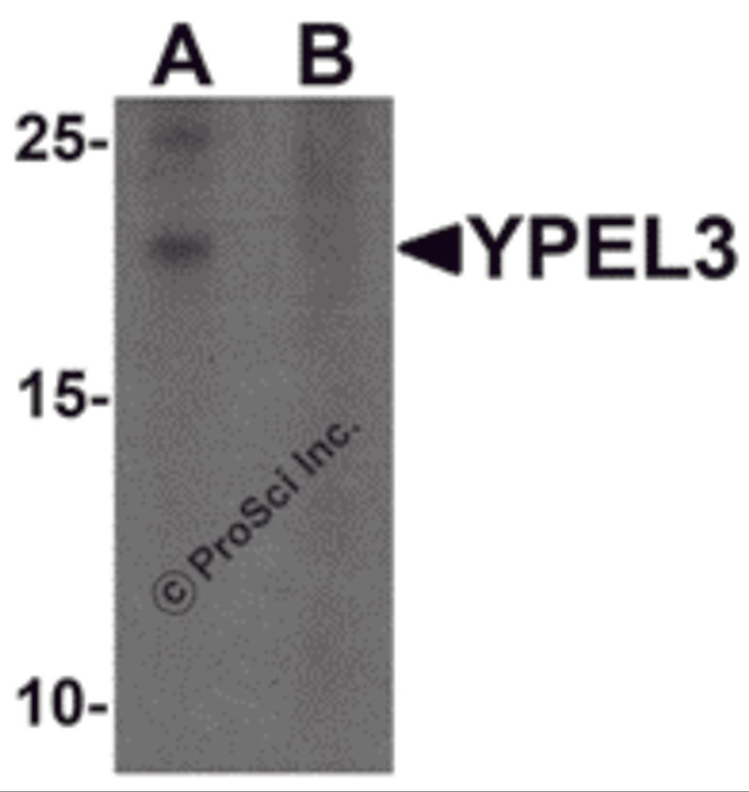 Western blot analysis of YPEL3 in A-20 cell lysate with YPEL3 antibody at 1 μg/mL in (A) the absence and (B) the presence of blocking peptide