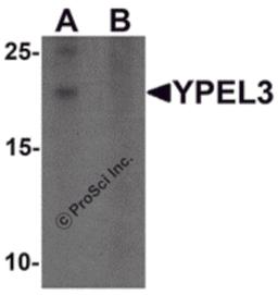 Western blot analysis of YPEL3 in A-20 cell lysate with YPEL3 antibody at 1 μg/mL in (A) the absence and (B) the presence of blocking peptide