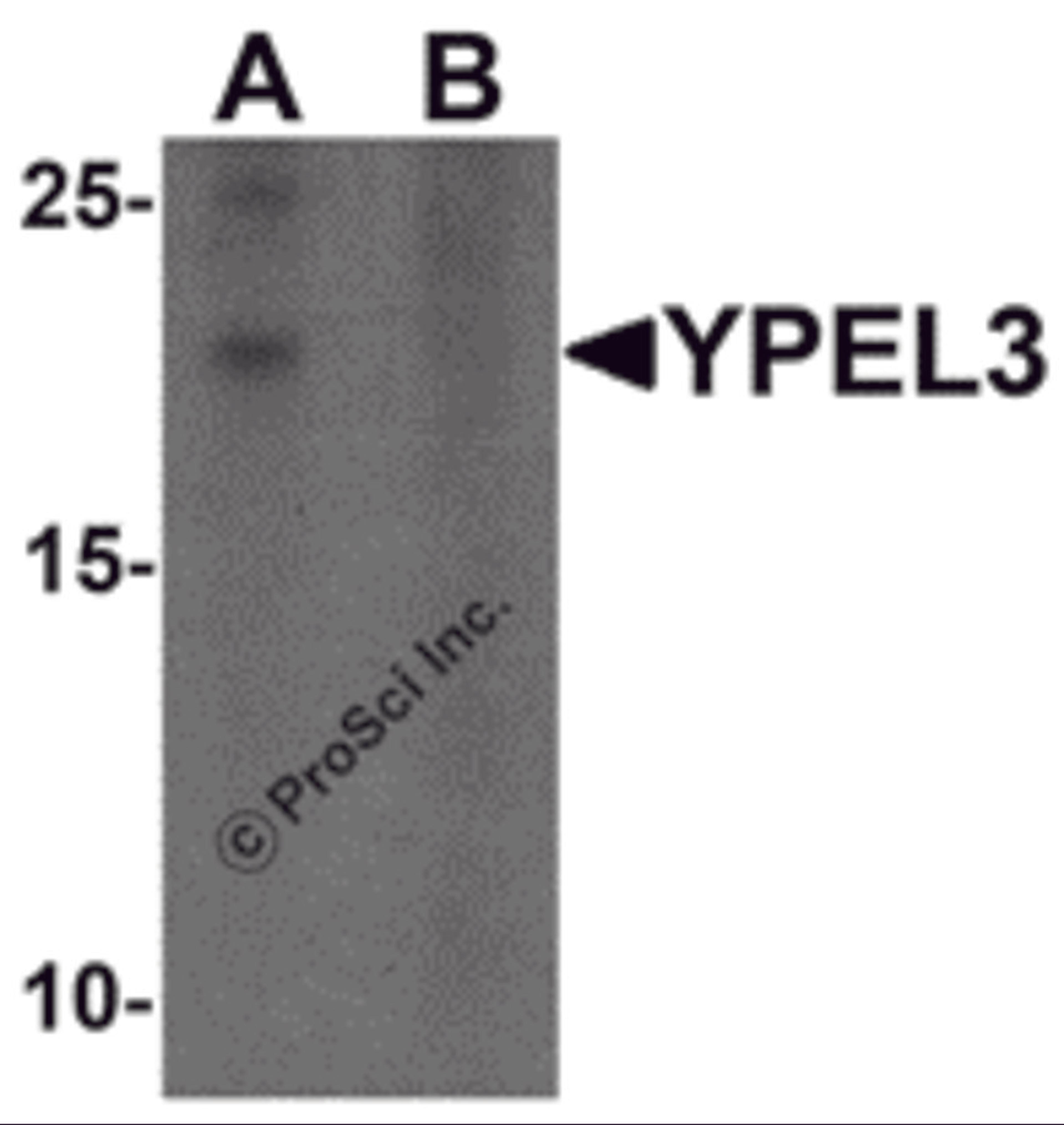 Western blot analysis of YPEL3 in A-20 cell lysate with YPEL3 antibody at 1 μg/mL in (A) the absence and (B) the presence of blocking peptide
