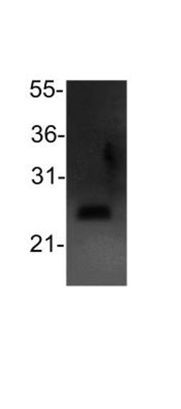 Western Blot: Bcl2 Antibody [NB100-56101] - analysis of Bcl2 in 293T cell lysate (30ug) using anti-Bcl2 antibody. Image from verified customer review.