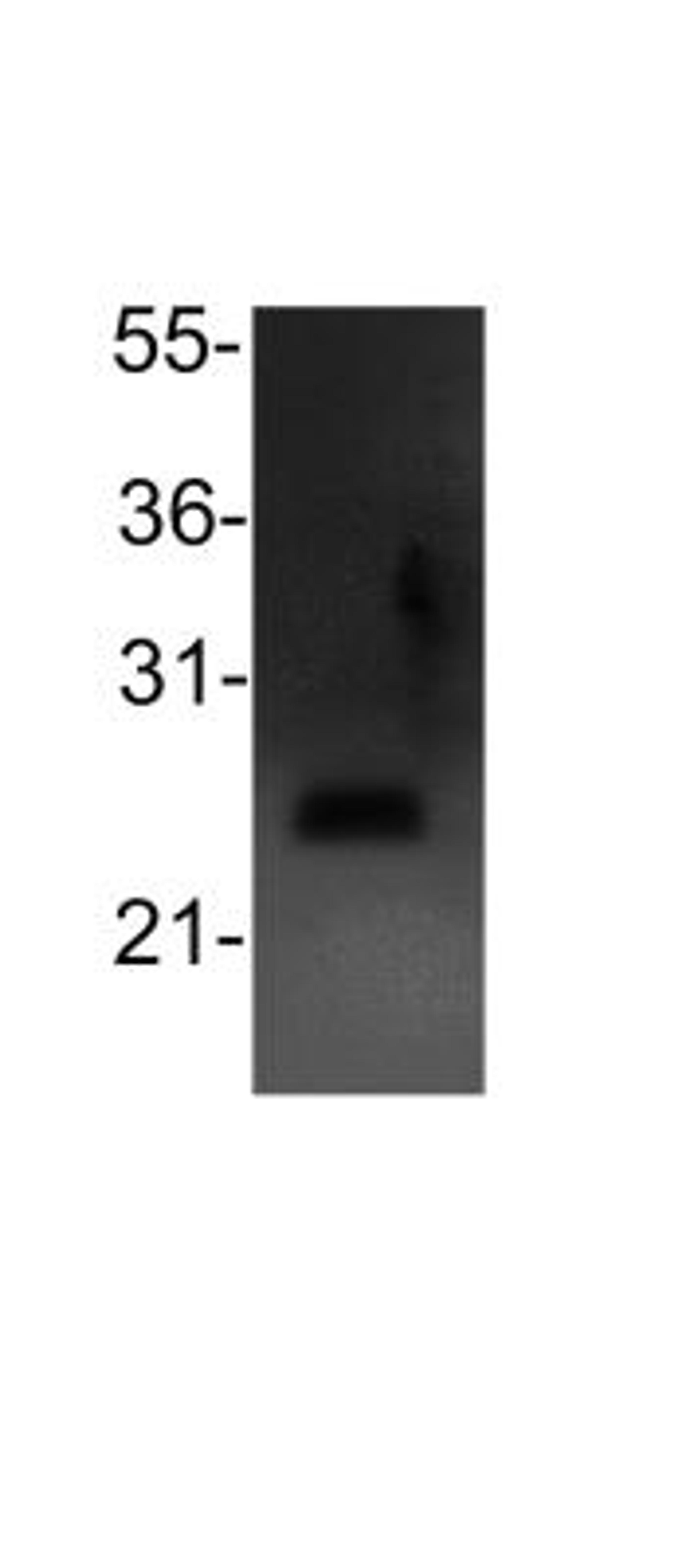 Western Blot: Bcl2 Antibody [NB100-56101] - analysis of Bcl2 in 293T cell lysate (30ug) using anti-Bcl2 antibody. Image from verified customer review.