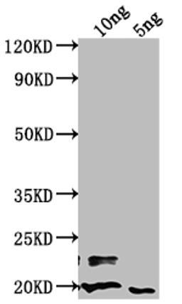 Western Blot. Positive WB detected in Recombinant protein. All lanes: nlpD antibody at 1:2000. Secondary. Goat polyclonal to rabbit IgG at 1/50000 dilution. Predicted band size: 55.29 kDa. Observed band size: 21 kDa.