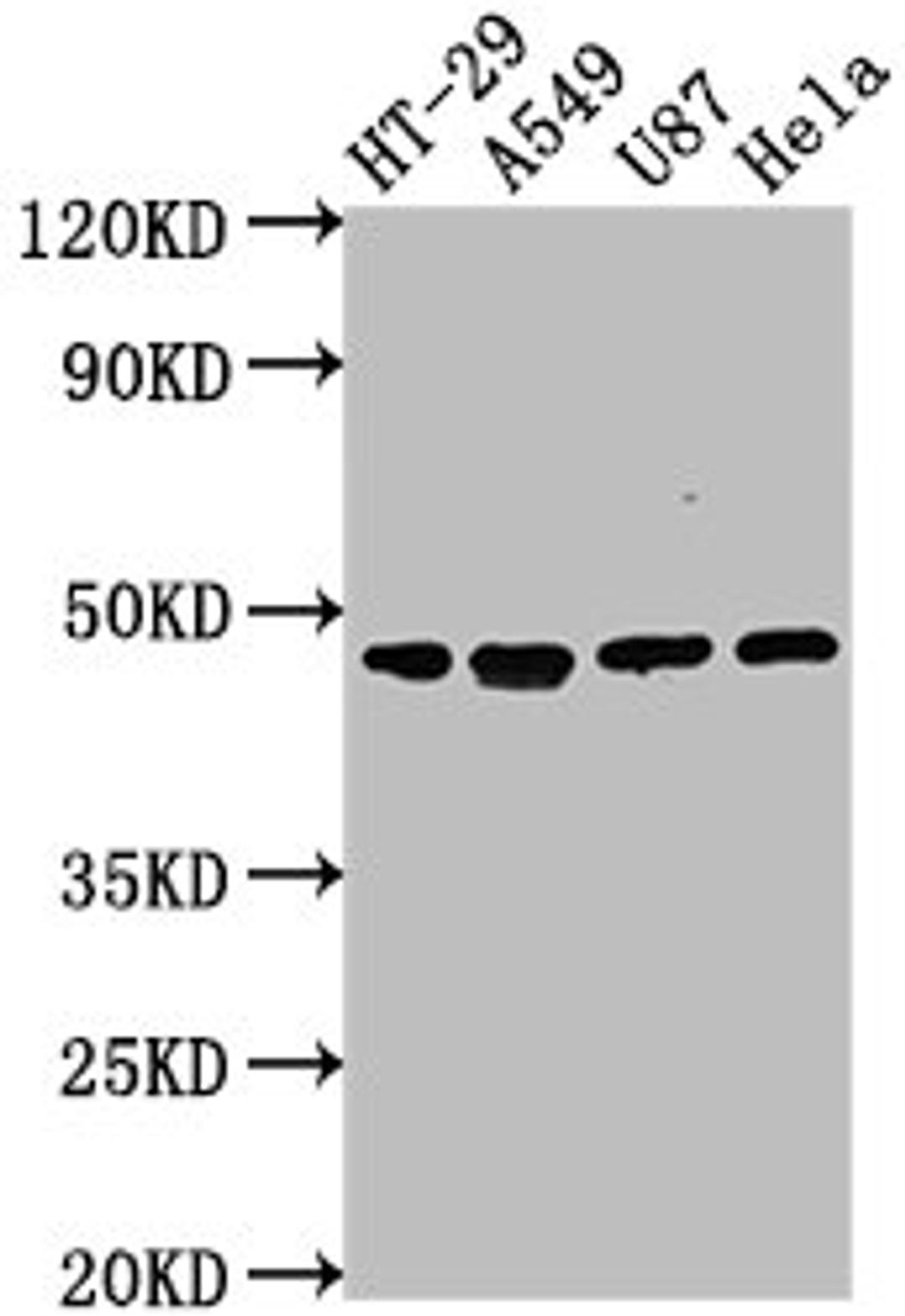 Western Blot. Positive WB detected in: HT-29 whole cell lysate, A549 whole cell lysate, U87 whole cell lysate, Hela whole cell lysate. All lanes: DPEP1 antibody at 1:2000. Secondary. Goat polyclonal to rabbit IgG at 1/50000 dilution. Predicted band size: 46 kDa. Observed band size: 46 kDa. 