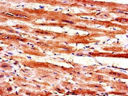 Immunohistochemical staining of human heart tissue using MAL antibody