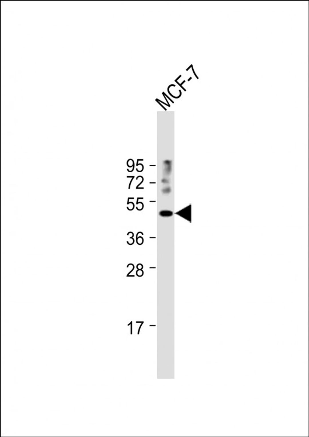 Western Blot at 1:1000 dilution + MCF-7 whole cell lysate Lysates/proteins at 20 ug per lane.