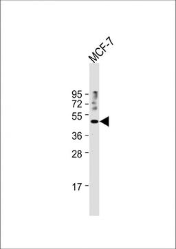 Western Blot at 1:1000 dilution + MCF-7 whole cell lysate Lysates/proteins at 20 ug per lane.