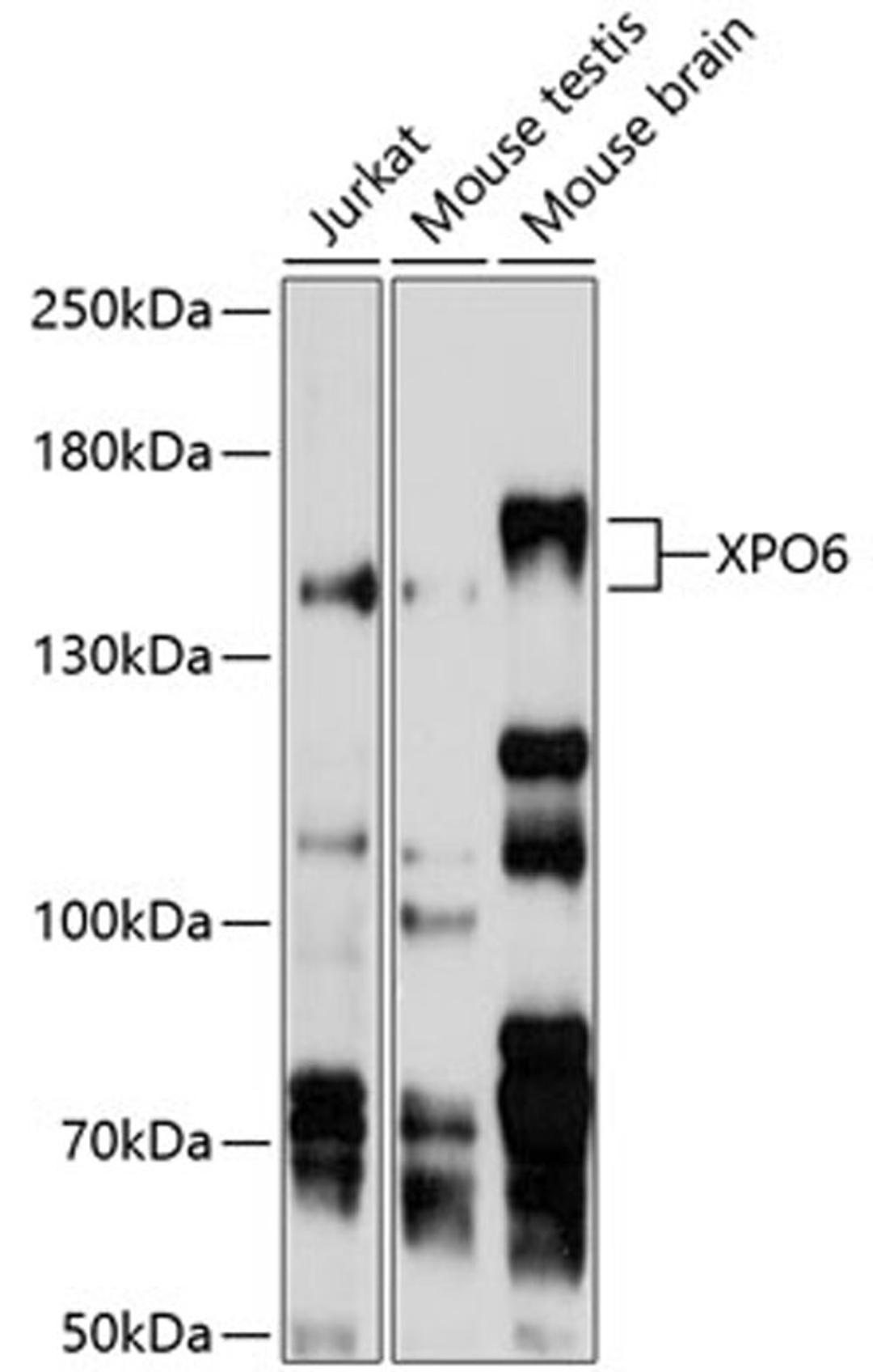 Western blot - XPO6 antibody (A10401)