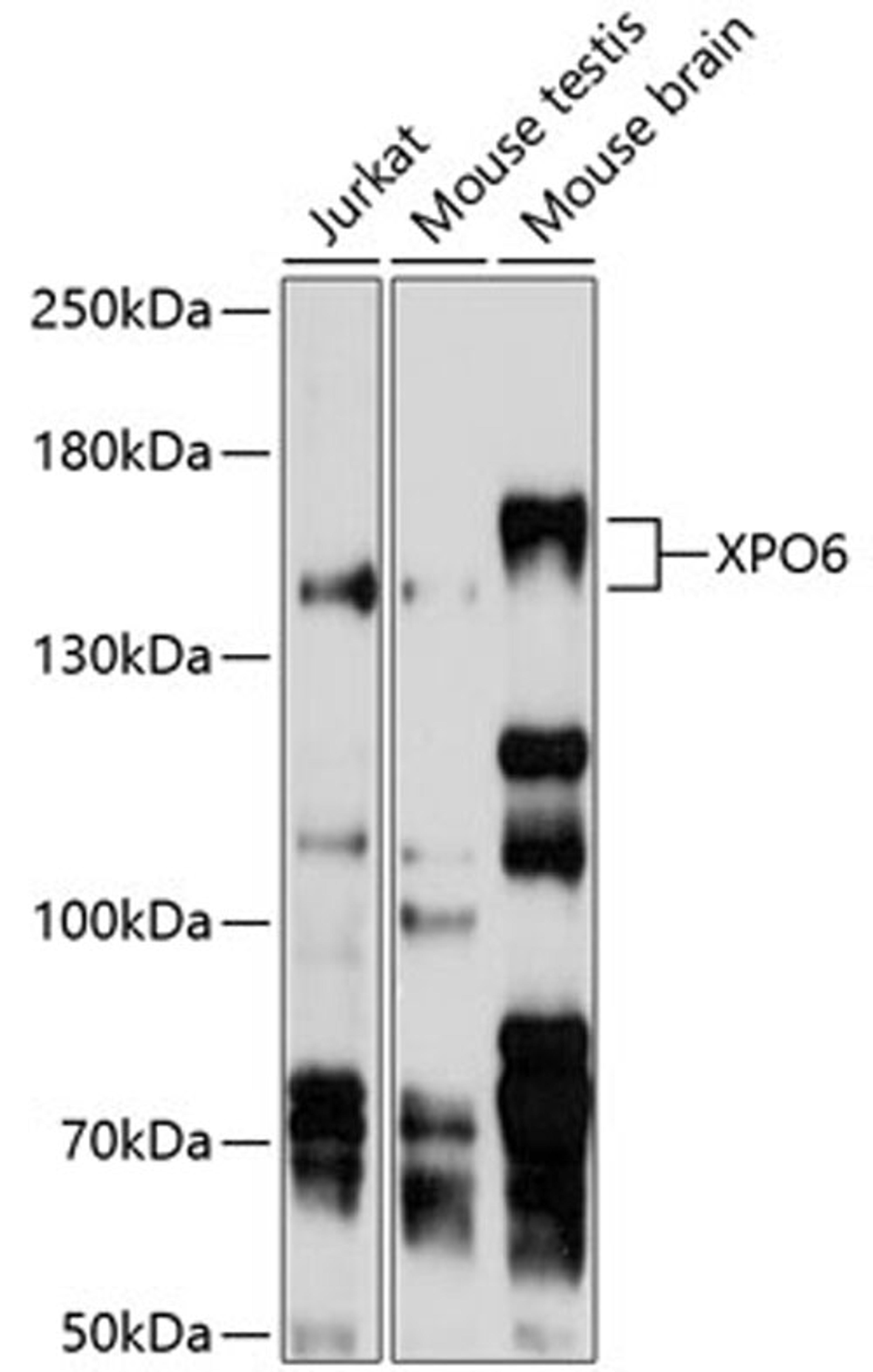 Western blot - XPO6 antibody (A10401)