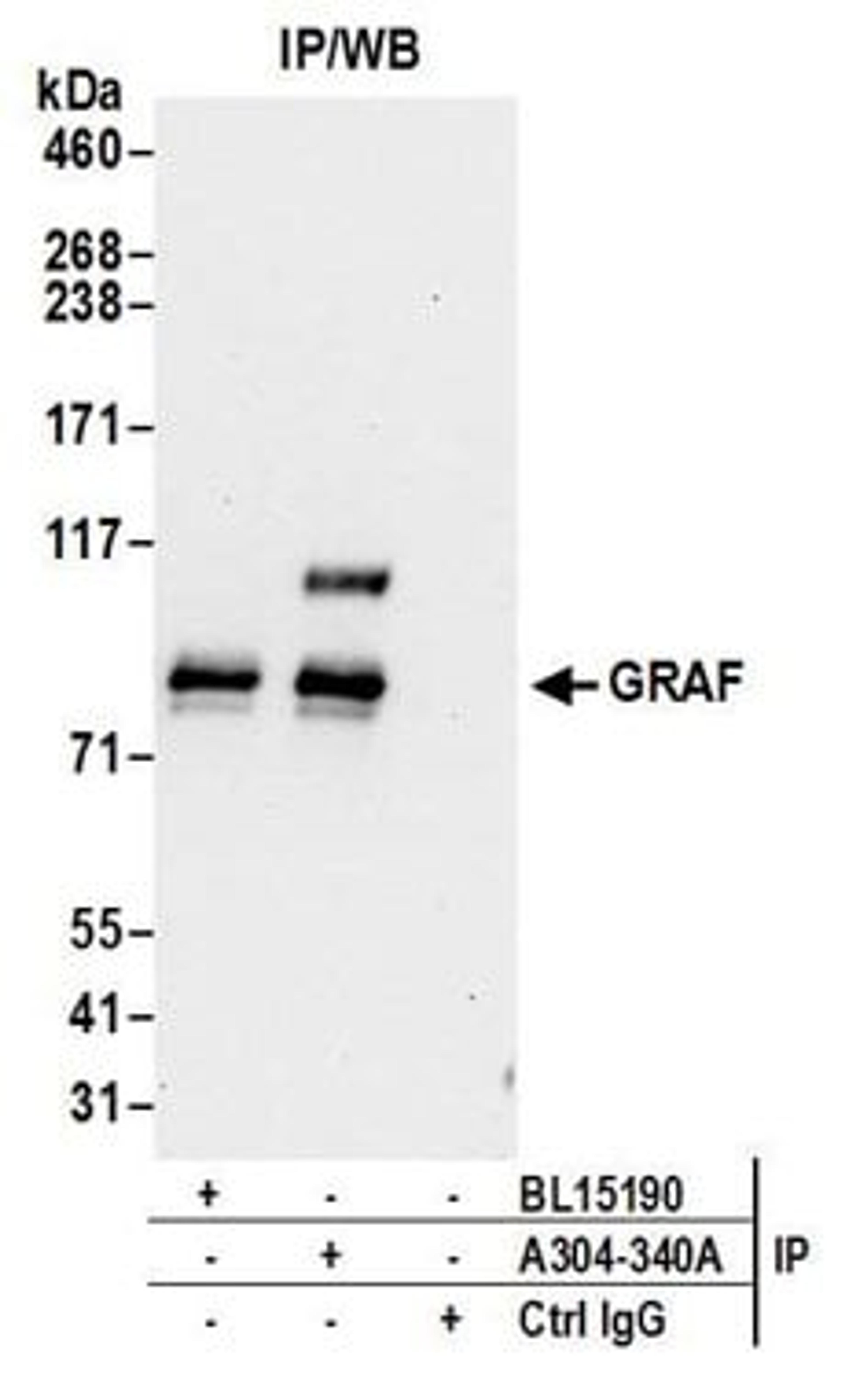 Detection of human GRAF by western blot of immunoprecipitates.