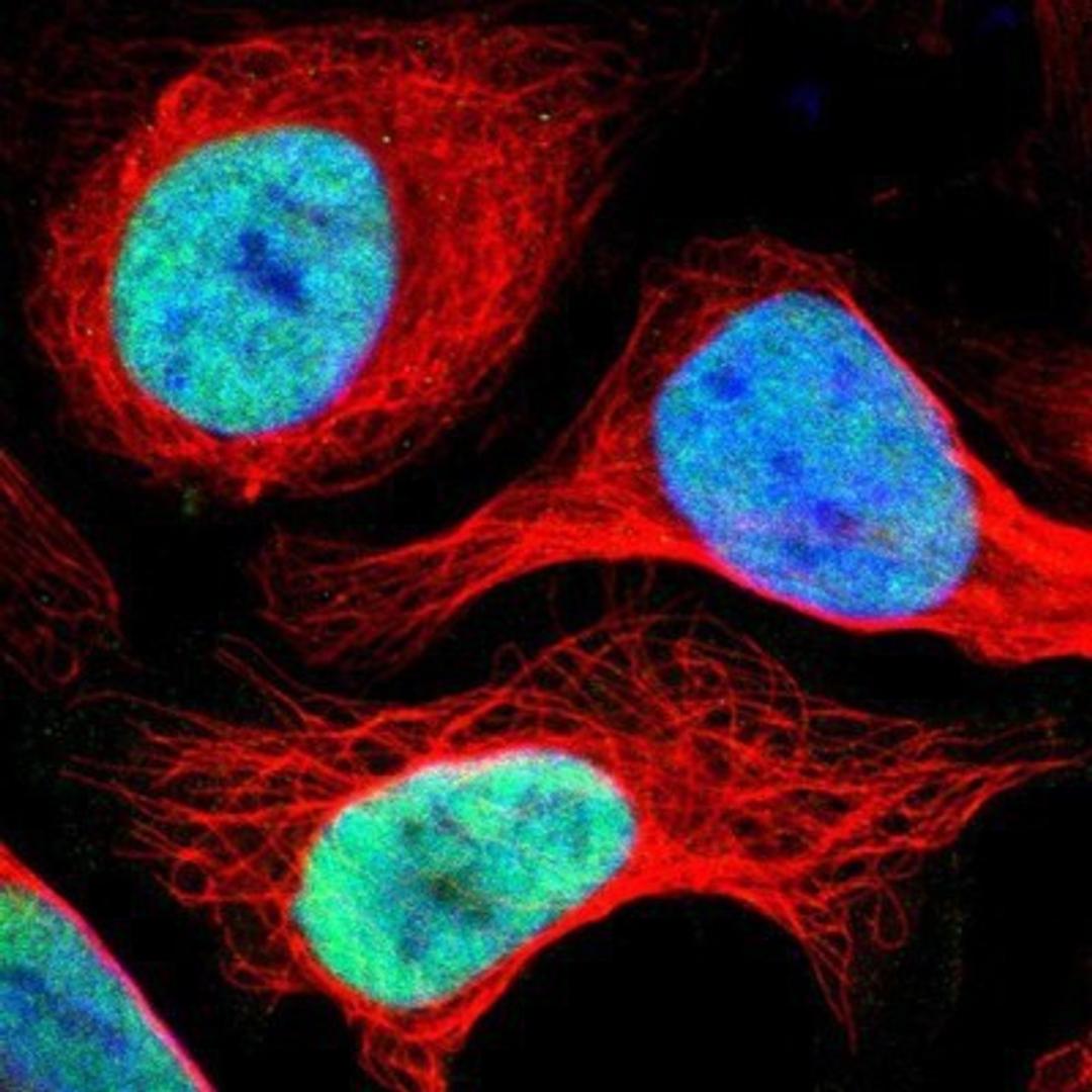 Immunocytochemistry/Immunofluorescence: ADNP Antibody [NBP1-89236] - Staining of human cell line U-2 OS shows positivity in nuclei but not nucleoli.