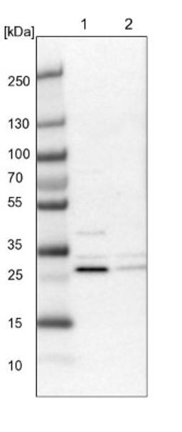 Western Blot: CCDC44 Antibody [NBP1-88160] - Lane 1: NIH-3T3 cell lysate (Mouse embryonic fibroblast cells)<br/>Lane 2: NBT-II cell lysate (Rat Wistar bladder tumour cells)