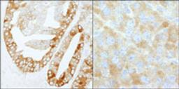 Detection of human and mouse FASN by immunohistochemistry.