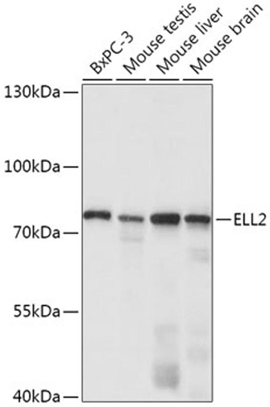 Western blot - ELL2 antibody (A17645)