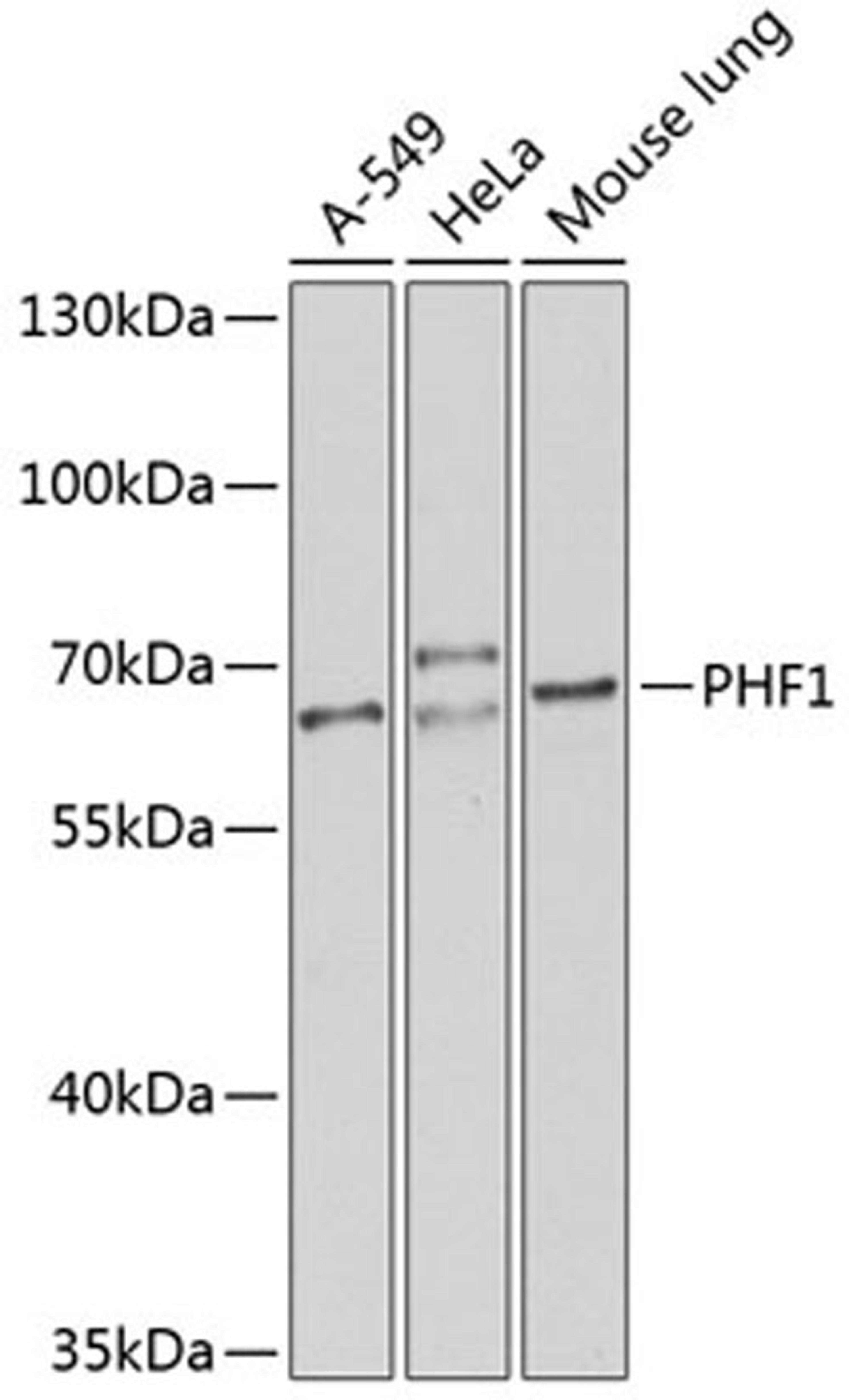 Western blot - PHF1 antibody (A8450)