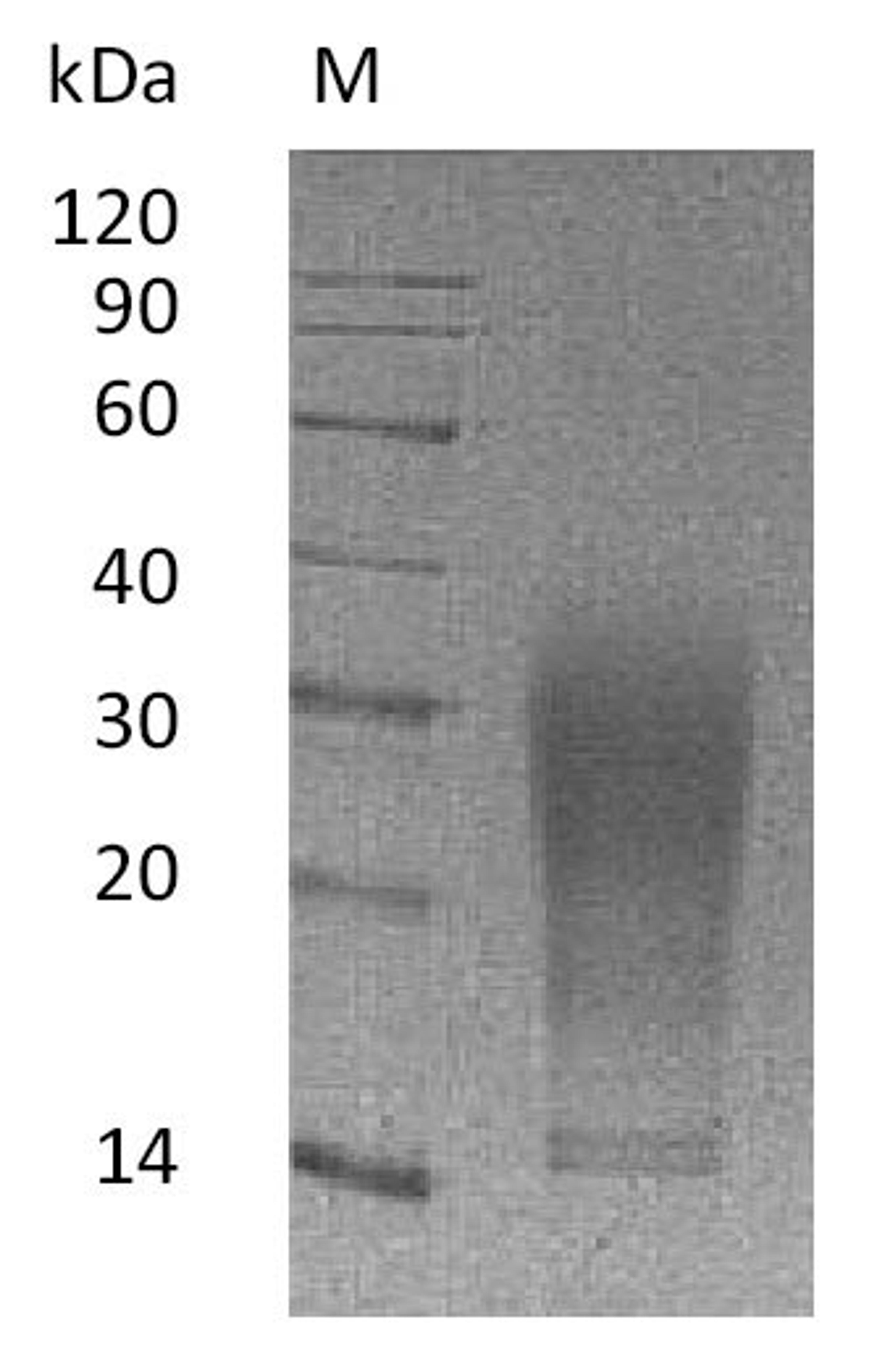 (Tris-Glycine gel) Discontinuous SDS-PAGE (reduced) with 5% enrichment gel and 15% separation gel.