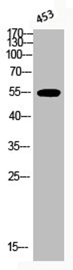 Western Blot analysis of 453 cells using Phospho-Akt1 (T450) Polyclonal Antibody