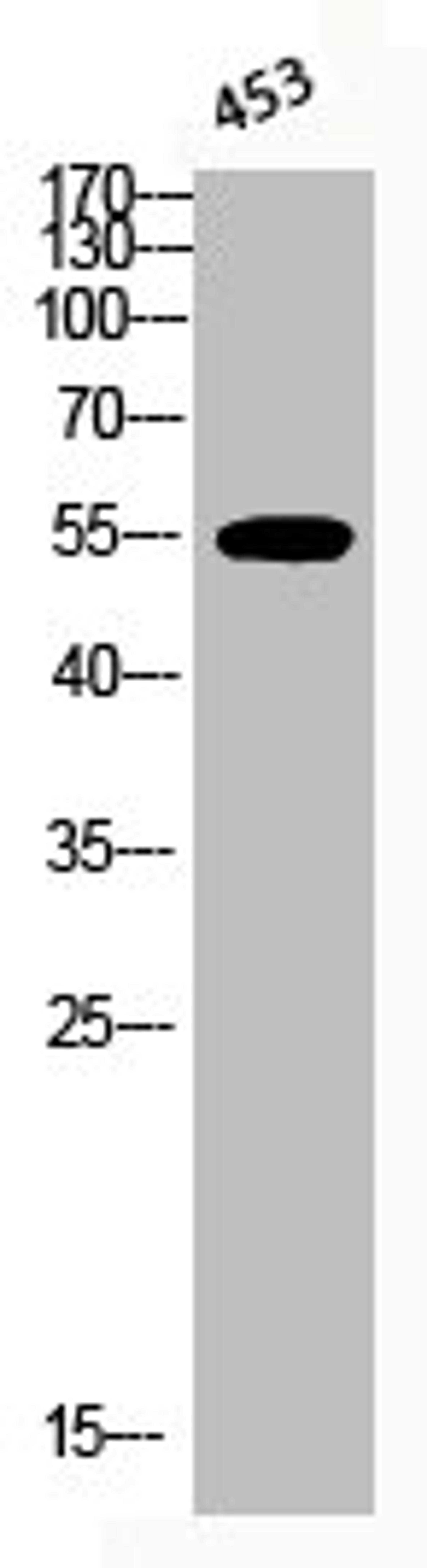 Western Blot analysis of 453 cells using Phospho-Akt1 (T450) Polyclonal Antibody