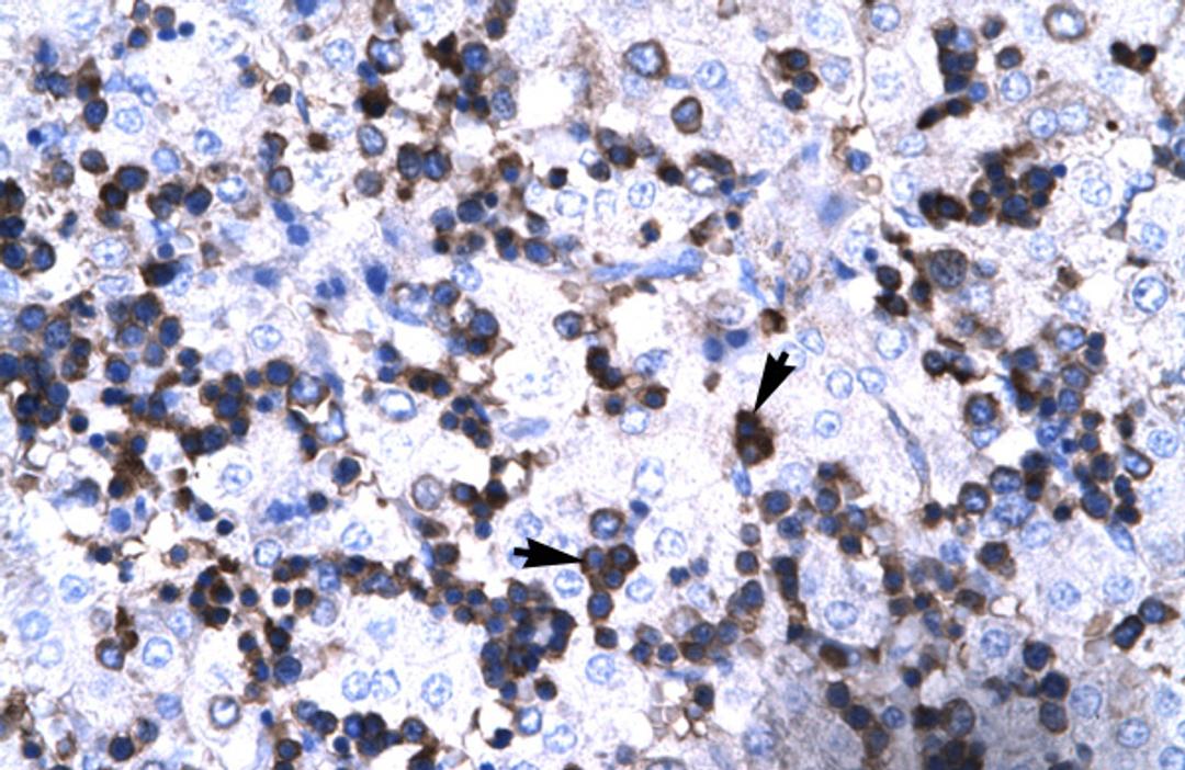 Antibody used in IHC on Human Liver.