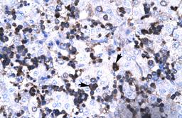 Antibody used in IHC on Human Liver.