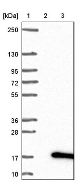 Western Blot: ACYP1 Antibody [NBP1-86314] - Lane 1: Marker [kDa] 250, 130, 95, 72, 55, 36, 28, 17, 10<br/>Lane 2: Negative control (vector only transfected HEK293T lysate)<br/>Lane 3: Over-expression lysate (Co-expressed with a C-terminal myc-DDK tag (~3.1 kDa) in mammalian HEK293T cells, LY420125)