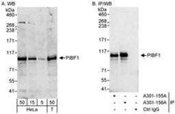 Detection of human PIBF1 by western blot and immunoprecipitation.