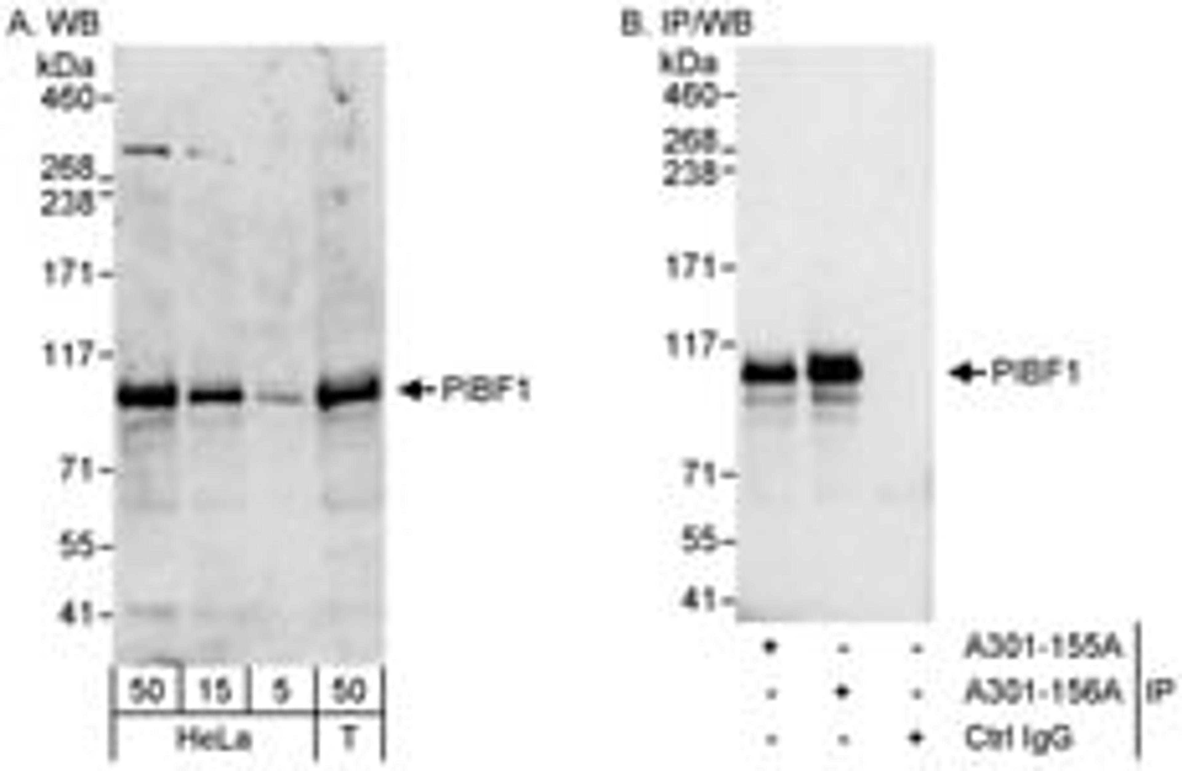 Detection of human PIBF1 by western blot and immunoprecipitation.